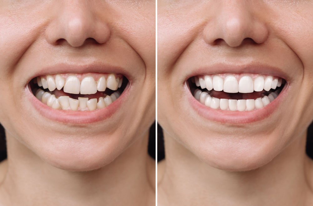 Bellingham Snohomish Dentist Office