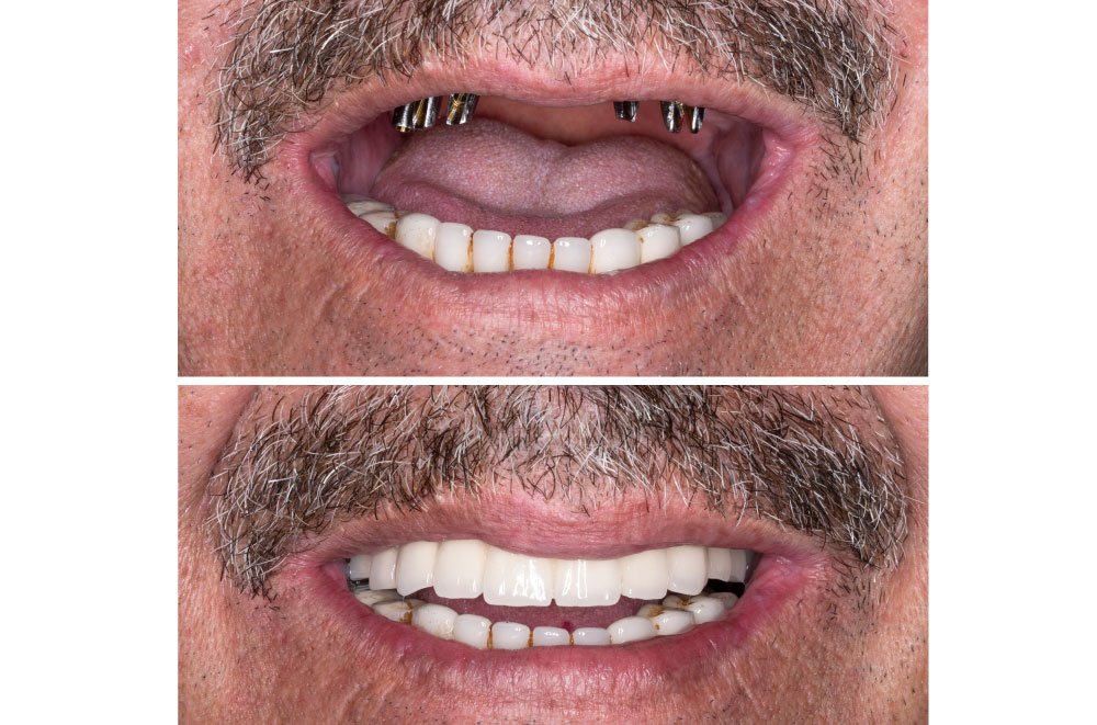 Bellingham Snohomish Dentist Office