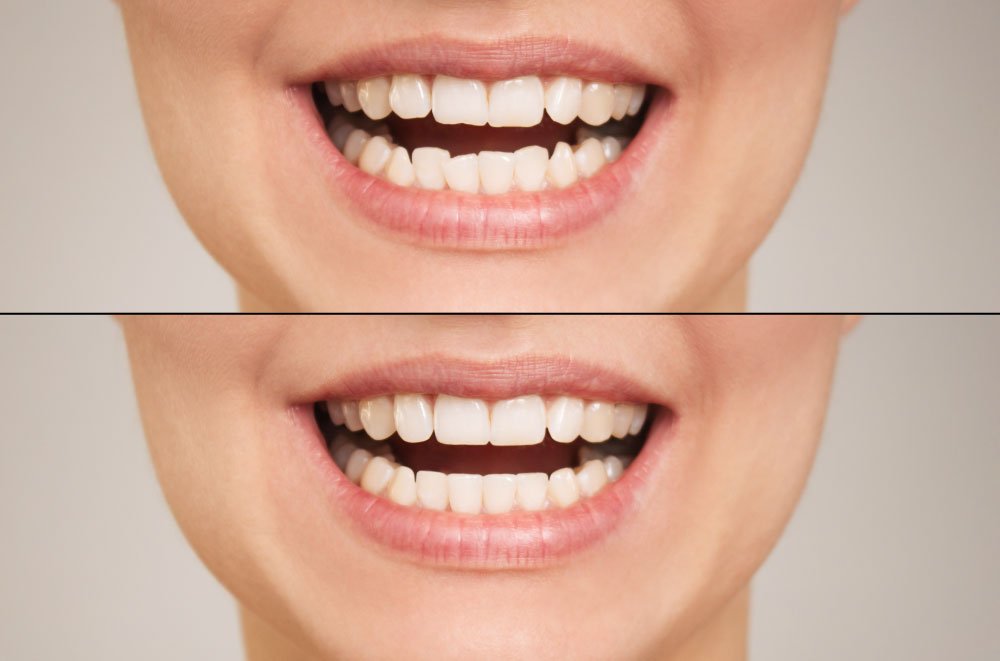 Bellingham Snohomish Dentist Office