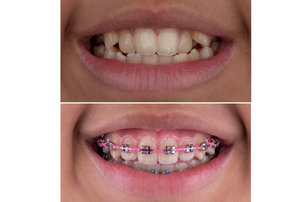 Bellingham Snohomish Dentist Office