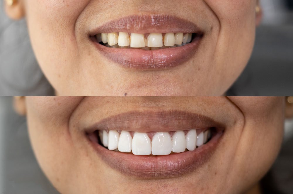 Bellingham Snohomish Dentist Office