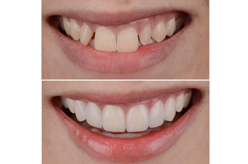 Garden Grove CA Dentist Office
