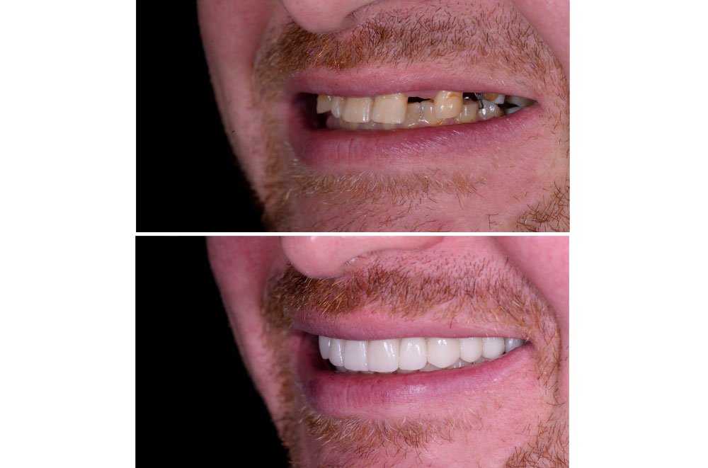 Bellingham Snohomish Dentist Office