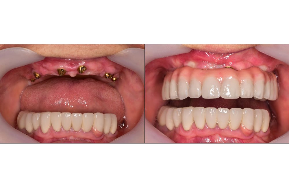 Bellingham Snohomish Dentist Office