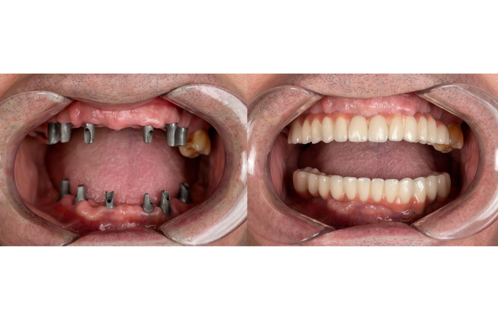 Bellingham Snohomish Dentist Office