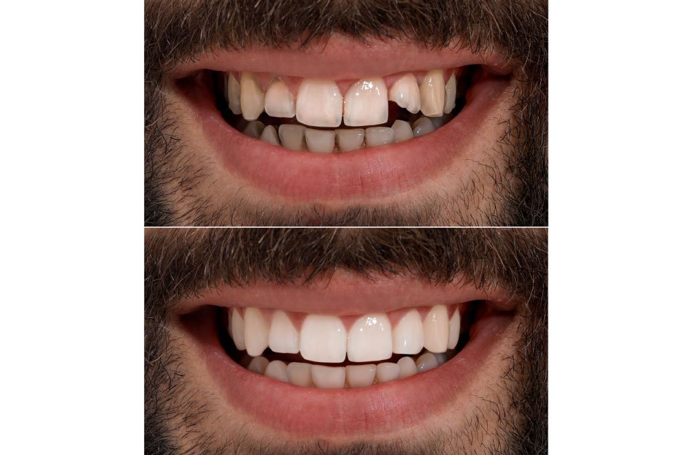 Bellingham Snohomish Dentist Office