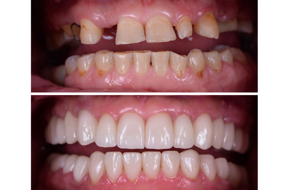 Bellingham Snohomish Dentist Office