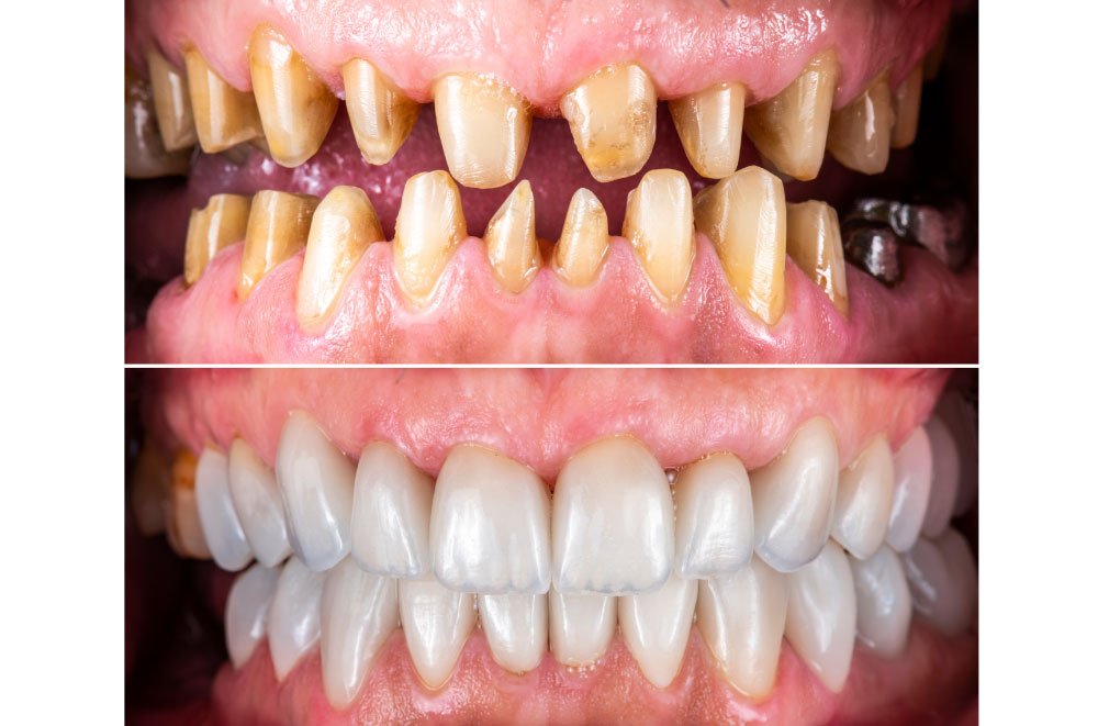 Bellingham Snohomish Dentist Office