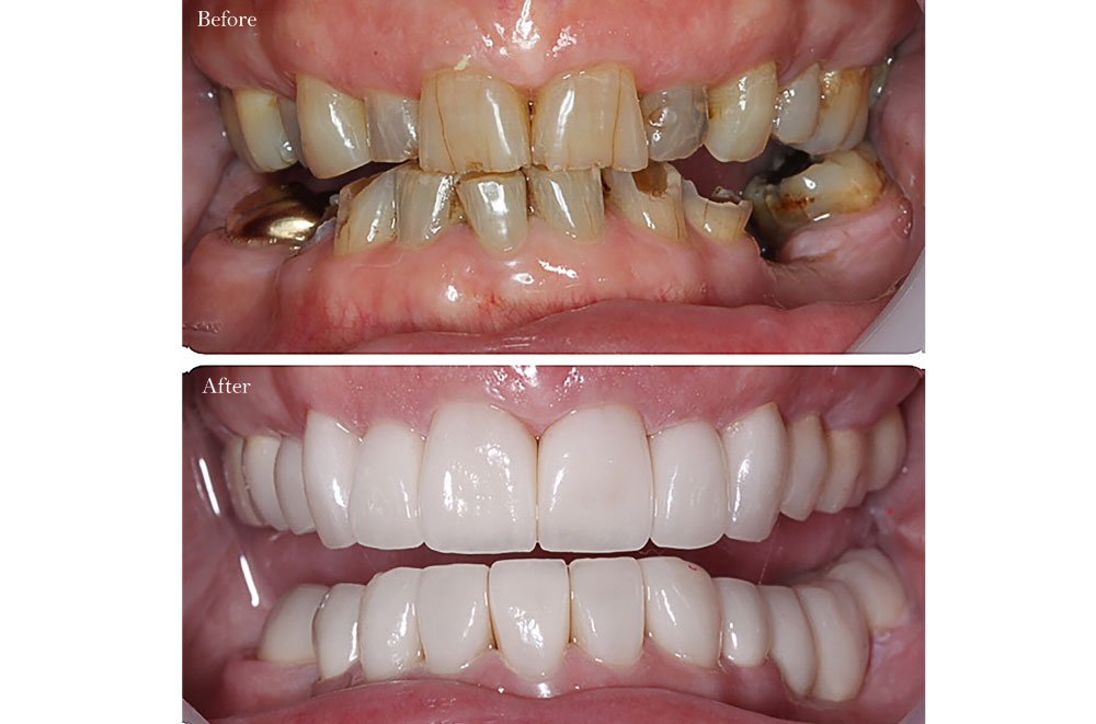 Bellingham Snohomish Dentist Office